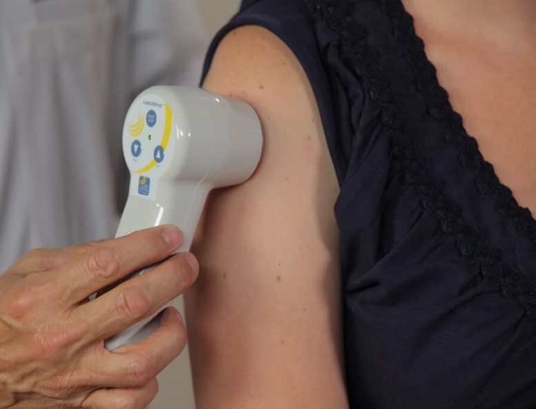 Laser Arm pain chiropractic care treatment