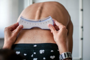 Chiropractic Therapy Treatment for Scoliosis
