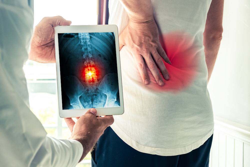 dr showing patient her spine xray hip pain